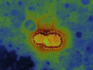 Coronavirus, anche il cortisone fra i farmaci che lo combattono