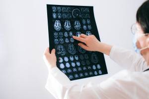 Neuroblastoma, ricerca italiana scopre le cause