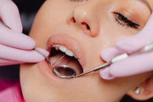 Malocclusione dentale: quali patologie pericolose può causare se si sottovaluta