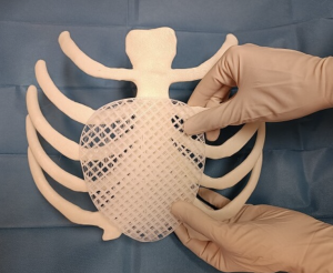 Protesi stampata in 3D riassorbibile, al Meyer il primo intervento in Europa