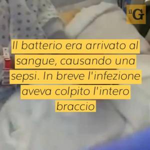 Racconto choc di una 49enne: si taglia con della carta e rischia di morire per un'infezione