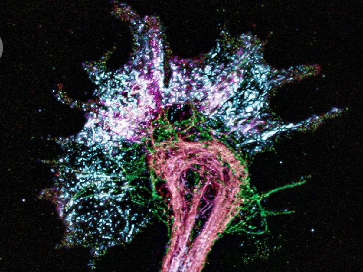 la materia si gonfia il microscopio vede cos236 il mit ingrandisce l8217invisibile da Ilgiornale.it la materia si gonfia il microscopio vede cos236 il mit ingrandisce l8217invisibile