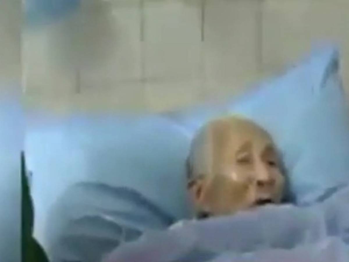 Si Risveglia Dal Coma Dopo 30 Anni