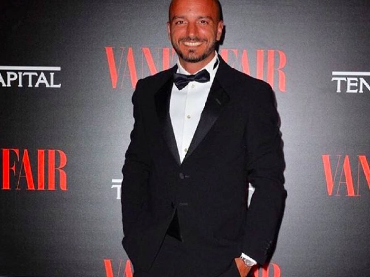 Perche Nicolas Vaporidis Ha Perso I Capelli