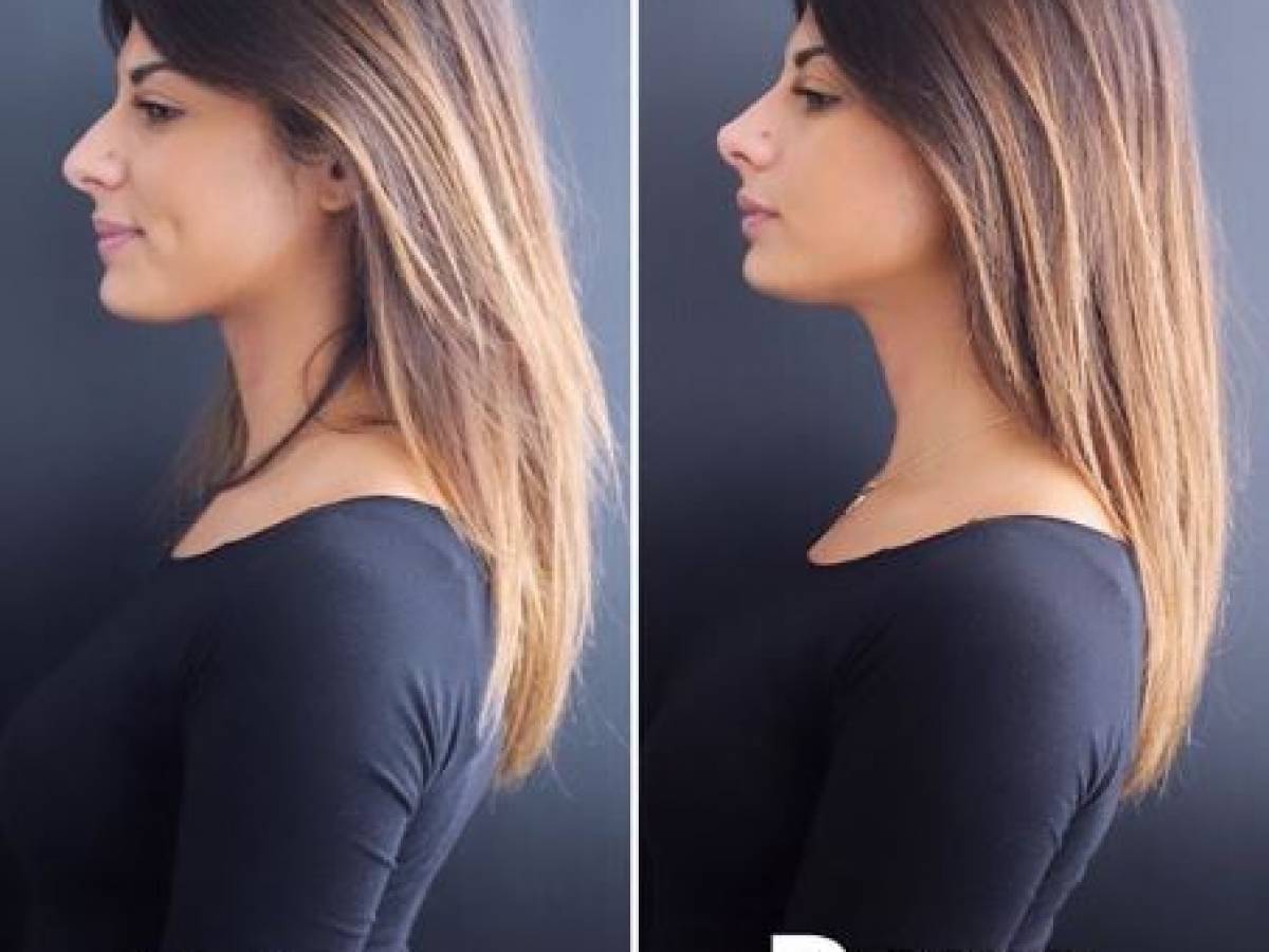 Giulia Cavaglia Ha Fatto Un Piccolo Ritocco Al Naso Ilgiornale It Giulia Cavaglia Ha Fatto Un Piccolo Ritocco Al Naso Ilgiornale It