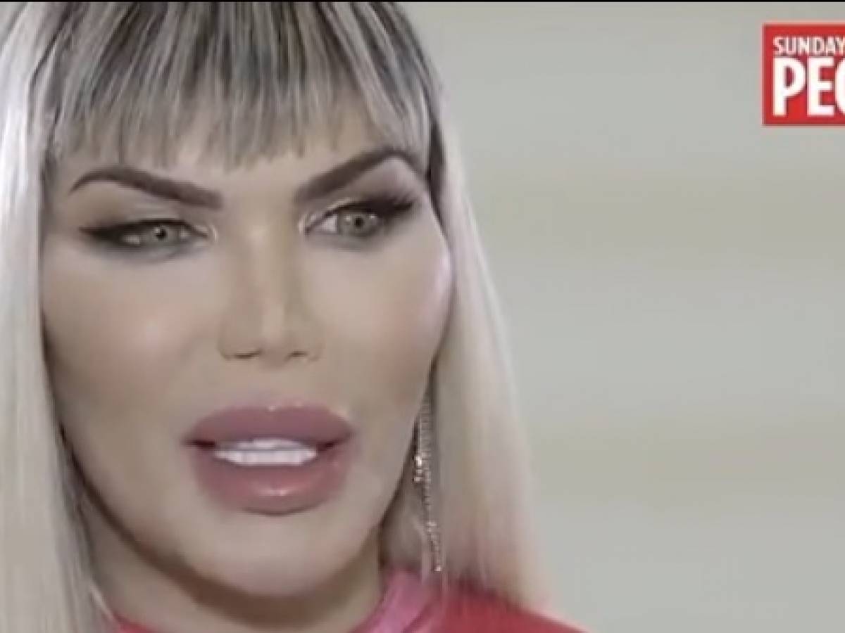 Il Ken Umano Diventa Donna Faro Rimuovere Genitali Ilgiornale It Il Ken Umano Diventa Donna Faro Rimuovere Genitali Ilgiornale It