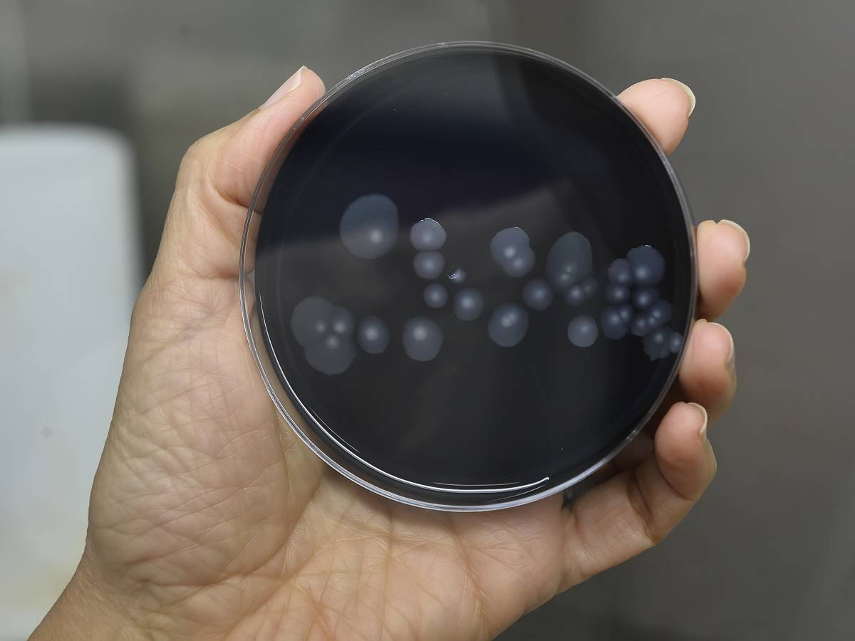 Paura legionella a Milano. Un morto e 11 contagiati a San Siro Paura legionella a Milano. Un morto e 11 contagiati a San Siro