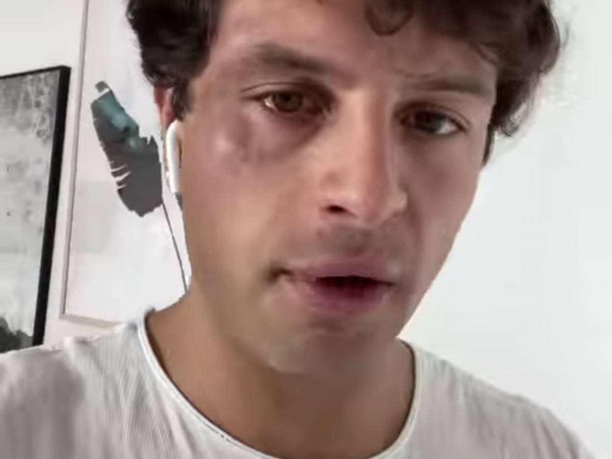 Iconize smaschera Soleil: "Mi ha detto di inscenare la finta aggressione omofoba"