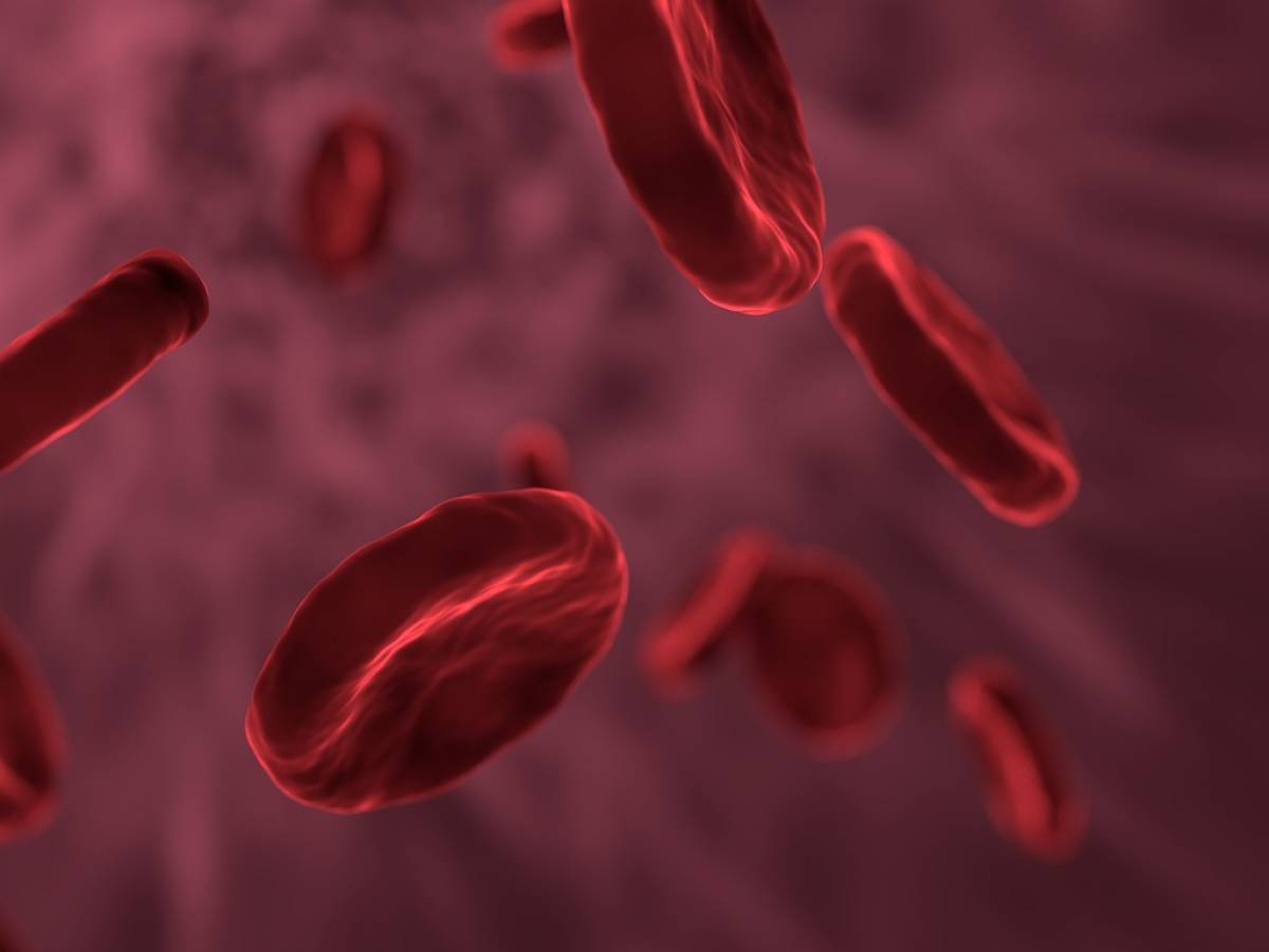 Beta-talassemia, Così Un Nuovo Farmaco Trasforma La Vita Dei Pazienti ...