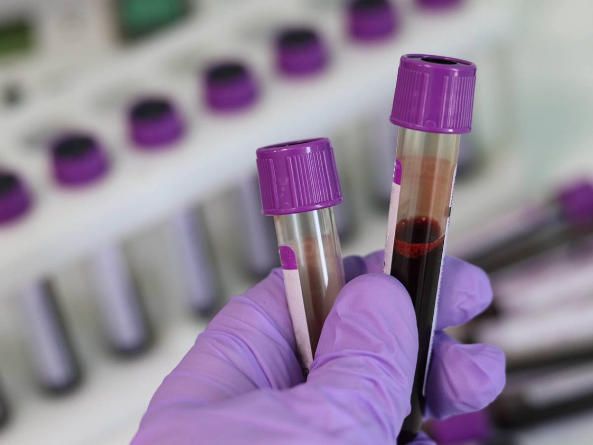 Covid, ecco perché il sangue dei vaccinati è sicuro