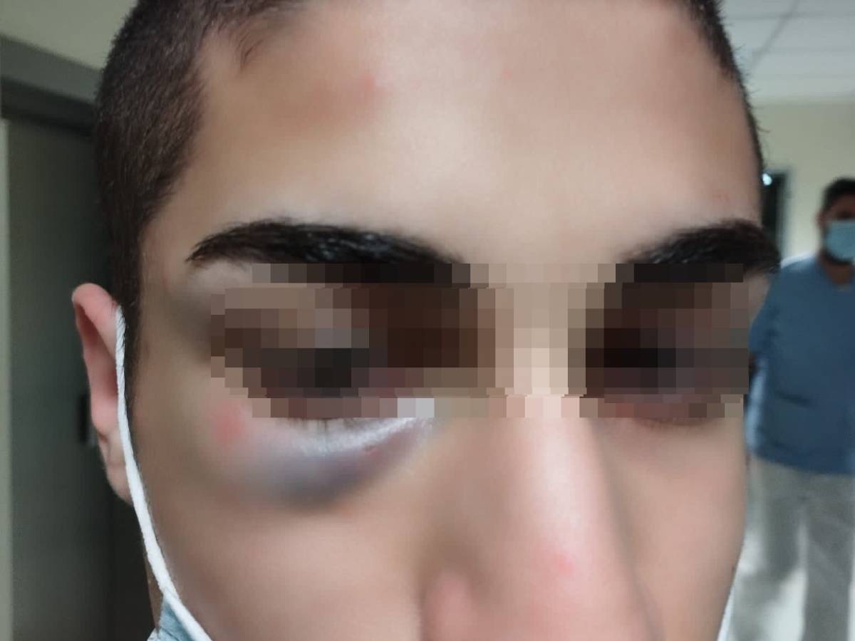 “fascist pig”.  Thus the militant of the social centers massacred the son of the former AN