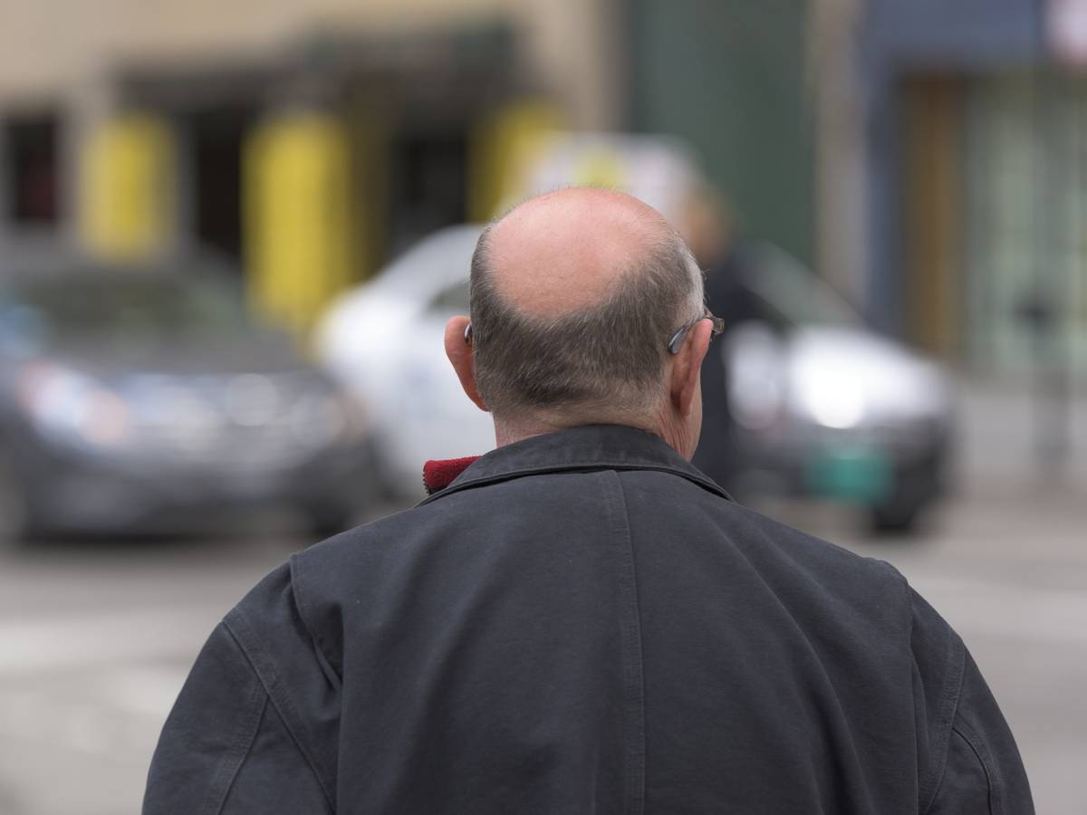l allarme sul farmaco contro la caduta dei capelli cosa provoca da Ilgiornale.it l allarme sul farmaco contro la caduta dei capelli cosa provoca