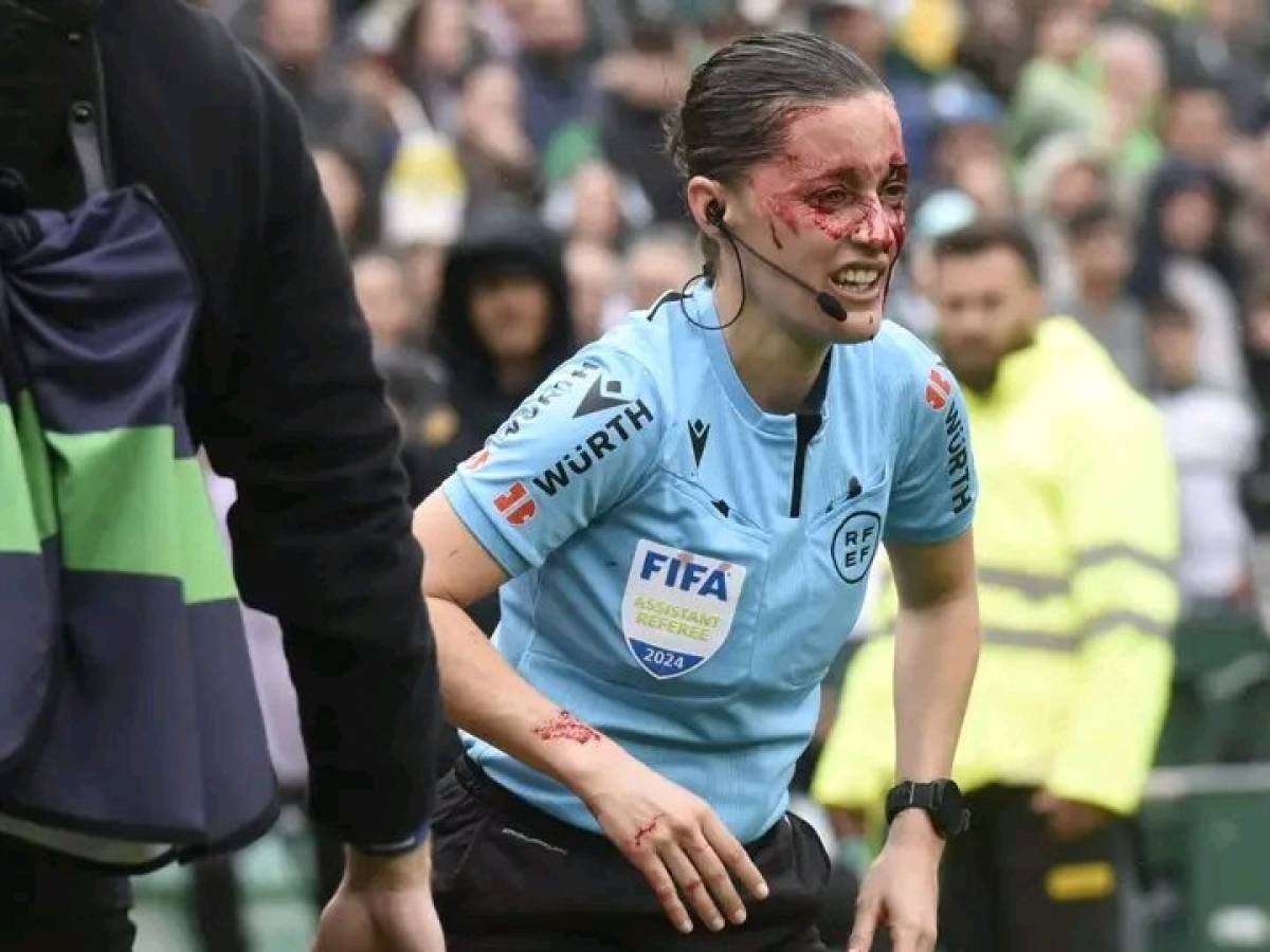 Assistant referee, face full of blood and shock: What happened in the Spanish League