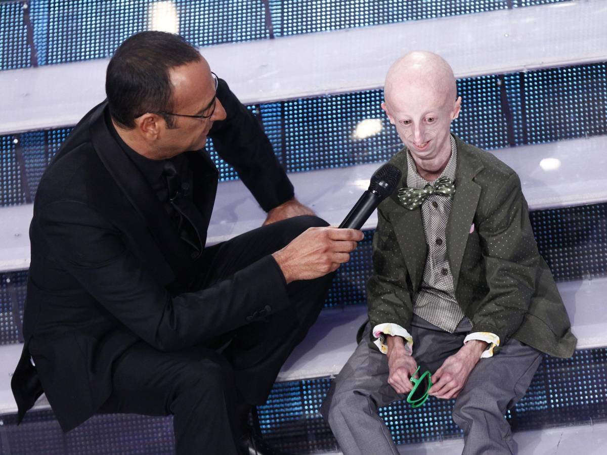 Cos progeria da Ilgiornale