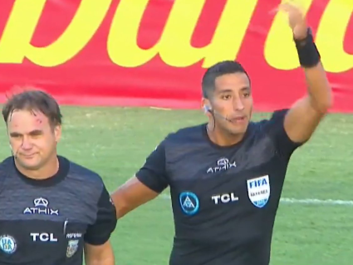 Guardalinee colpito in testa da un tubo, poi il sangue: cosa è successo in campo