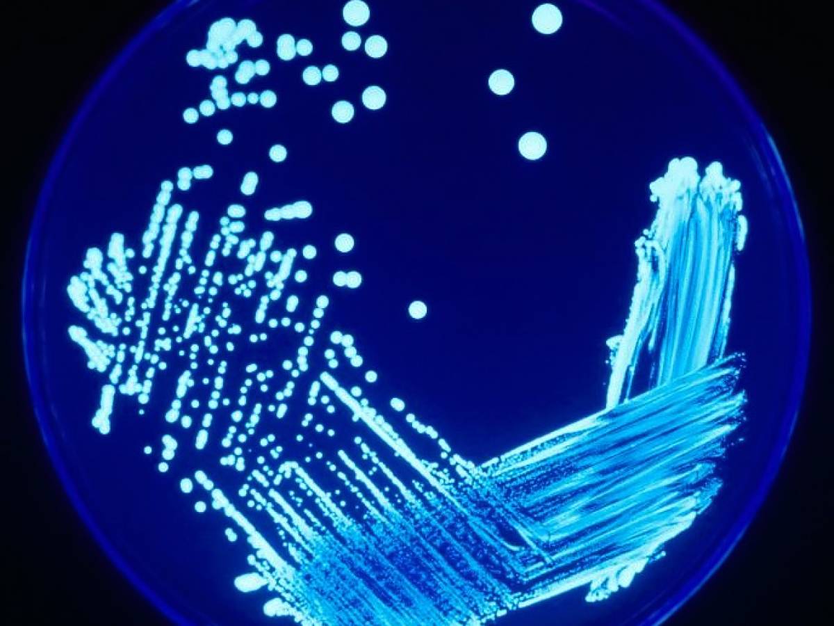Allarme Legionella, a Milano un morto e casi in aumento: l Allarme Legionella, a Milano un morto e casi in aumento: l