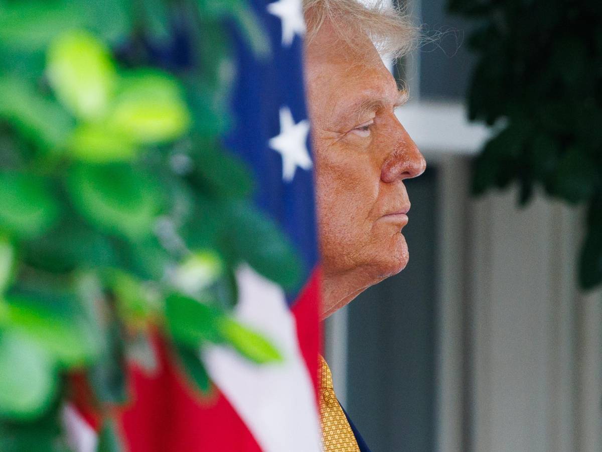 "Insufficienza venosa cronica": come sta davvero Donald Trump