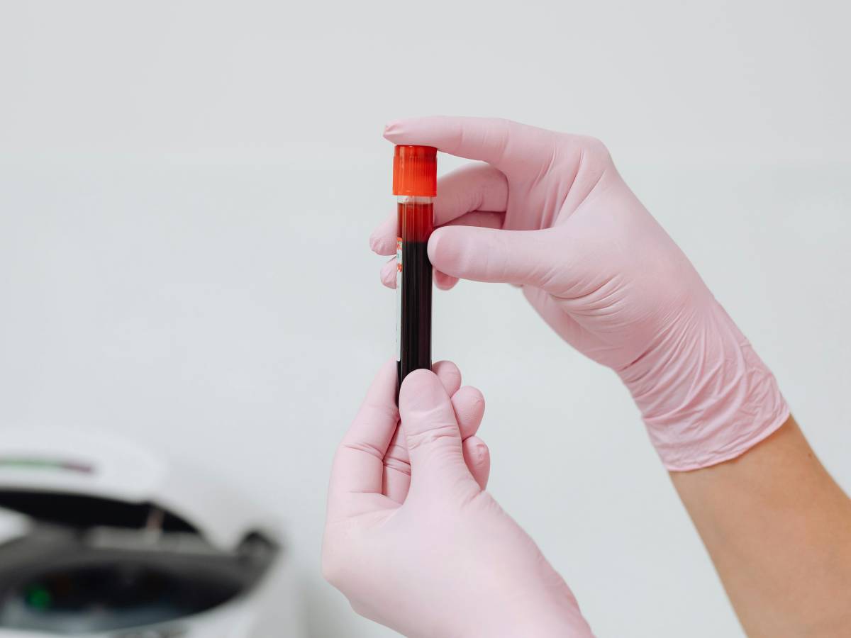 potassio alto nel sangue attenzione a questi sintomi