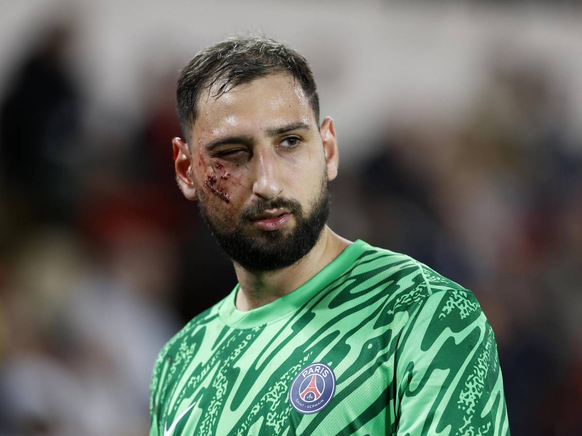 quella cicatrice sul volto di gigio che il psg ha dimenticato troppo in fretta