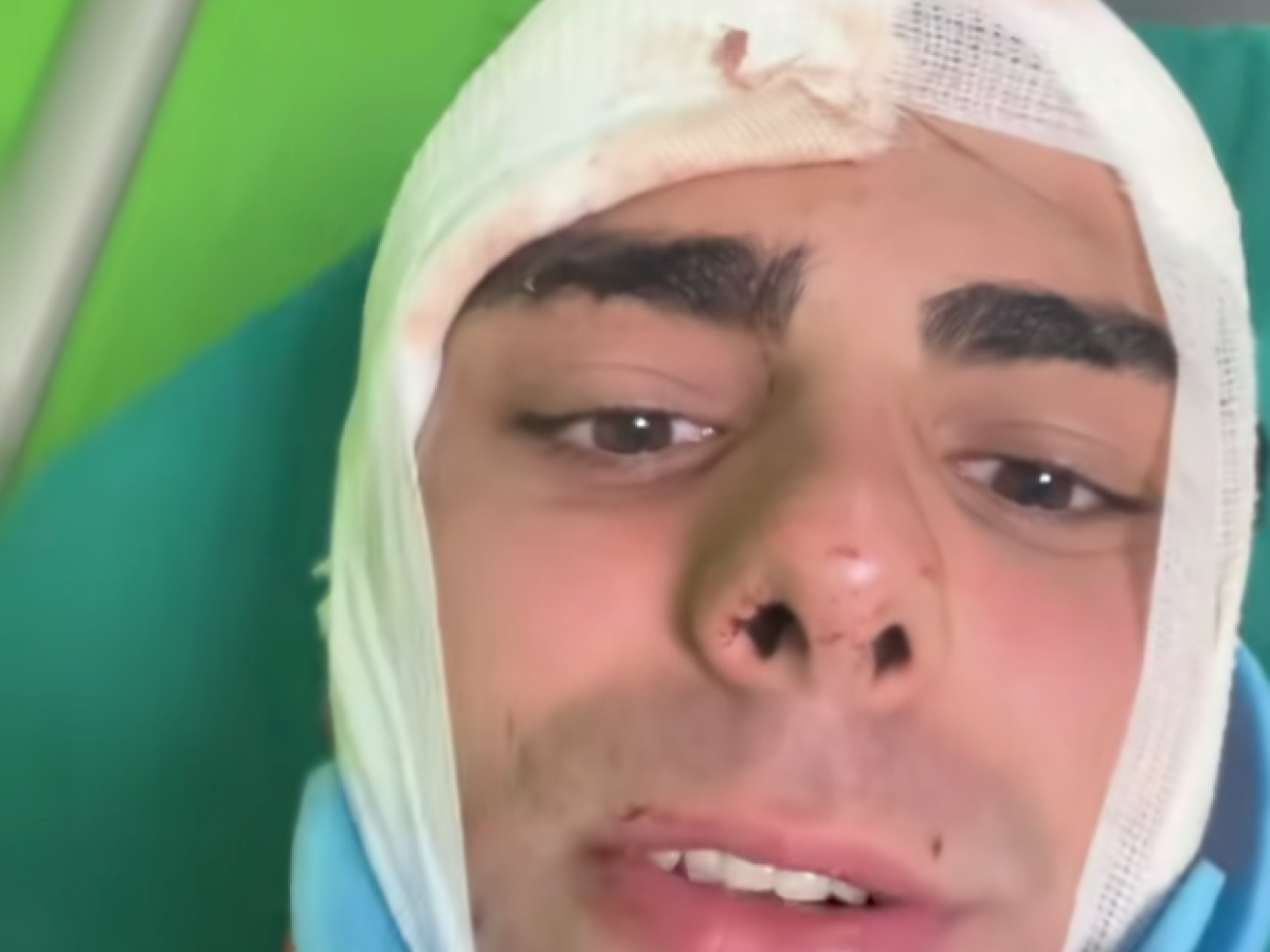 Alessandro, aggredito a Milano per un orologio: "Preso a martellate in testa. Ho rischiato di morire" Alessandro, aggredito a Milano per un orologio: "Preso a martellate in testa. Ho rischiato di morire"