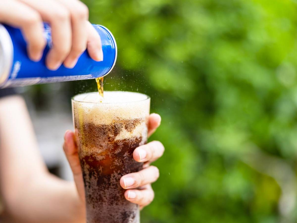 le bevande zuccherate aumentano il rischio di caduta dei capelli
