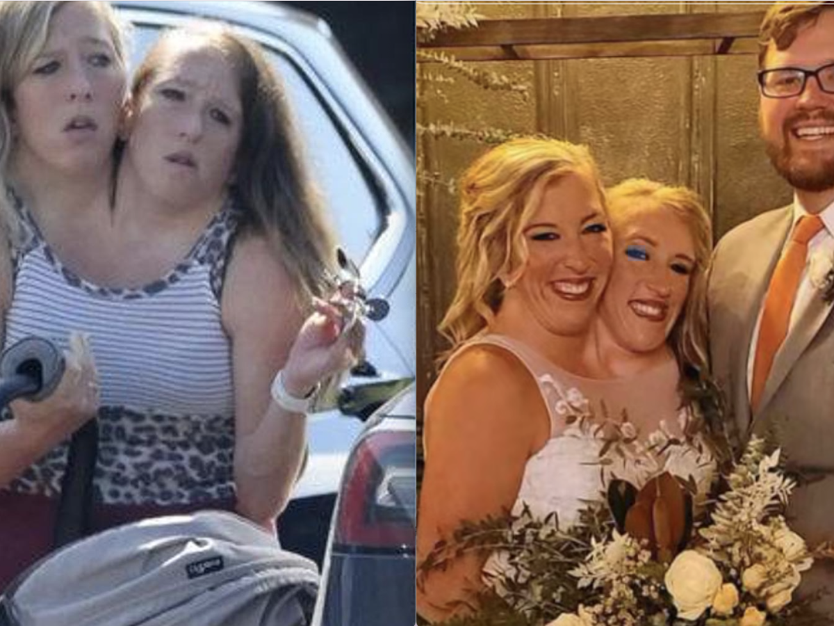 Abby e Brittany Hensel: le gemelle siamesi diventano mamme, ma chi è la madre biologica? Abby e Brittany Hensel: le gemelle siamesi diventano mamme, ma chi è la madre biologica?