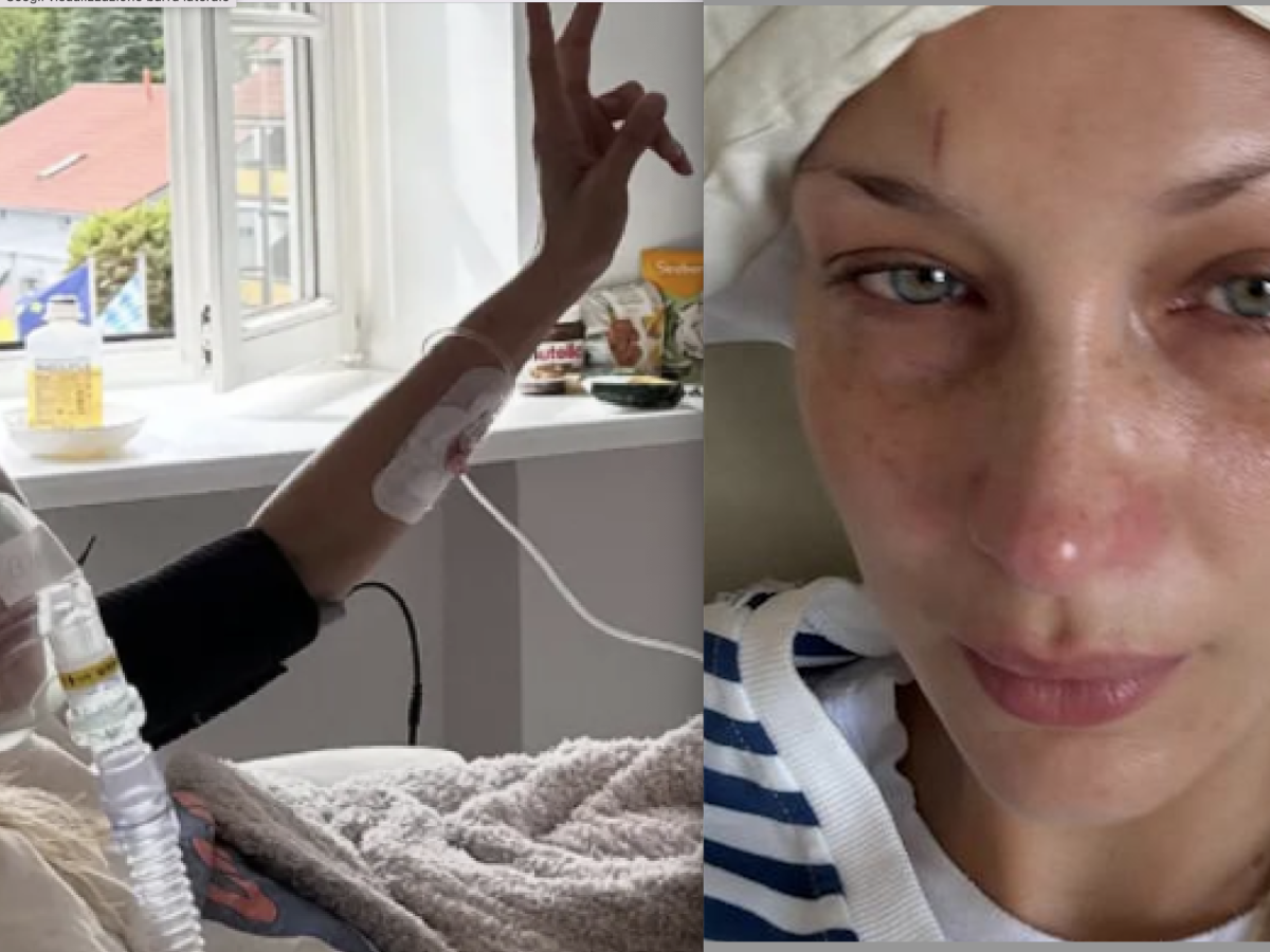 Bella Hadid in ospedale: preoccupano le sue condizioni a causa della malattia di Lyme