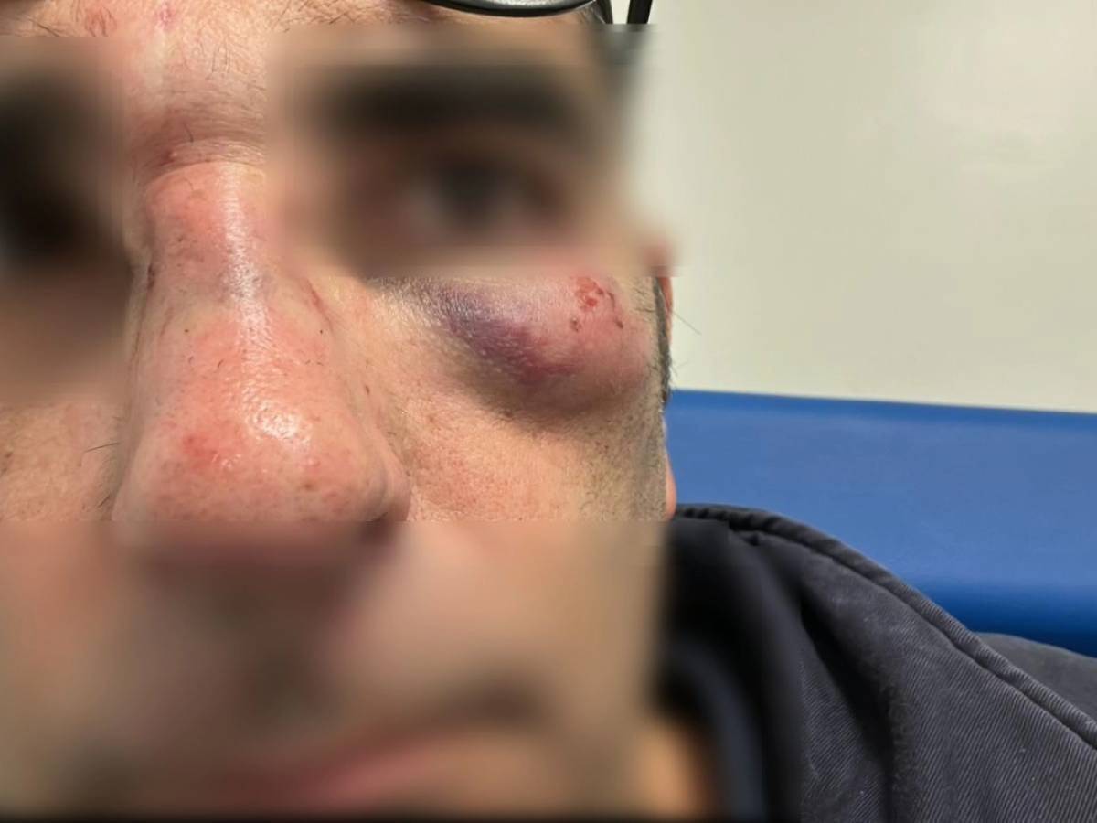 Non ha il biglietto e massacra di botte un esponente di FdI: fermato uno straniero Non ha il biglietto e massacra di botte un esponente di FdI: fermato uno straniero