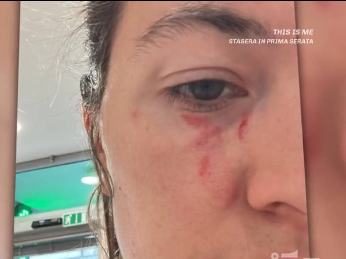 I colpi al volto, il selfie e i coltelli del killer: la violenza di Soncin contro Pamela. E lui non risponde ai pm I colpi al volto, il selfie e i coltelli del killer: la violenza di Soncin contro Pamela. E lui non risponde ai pm