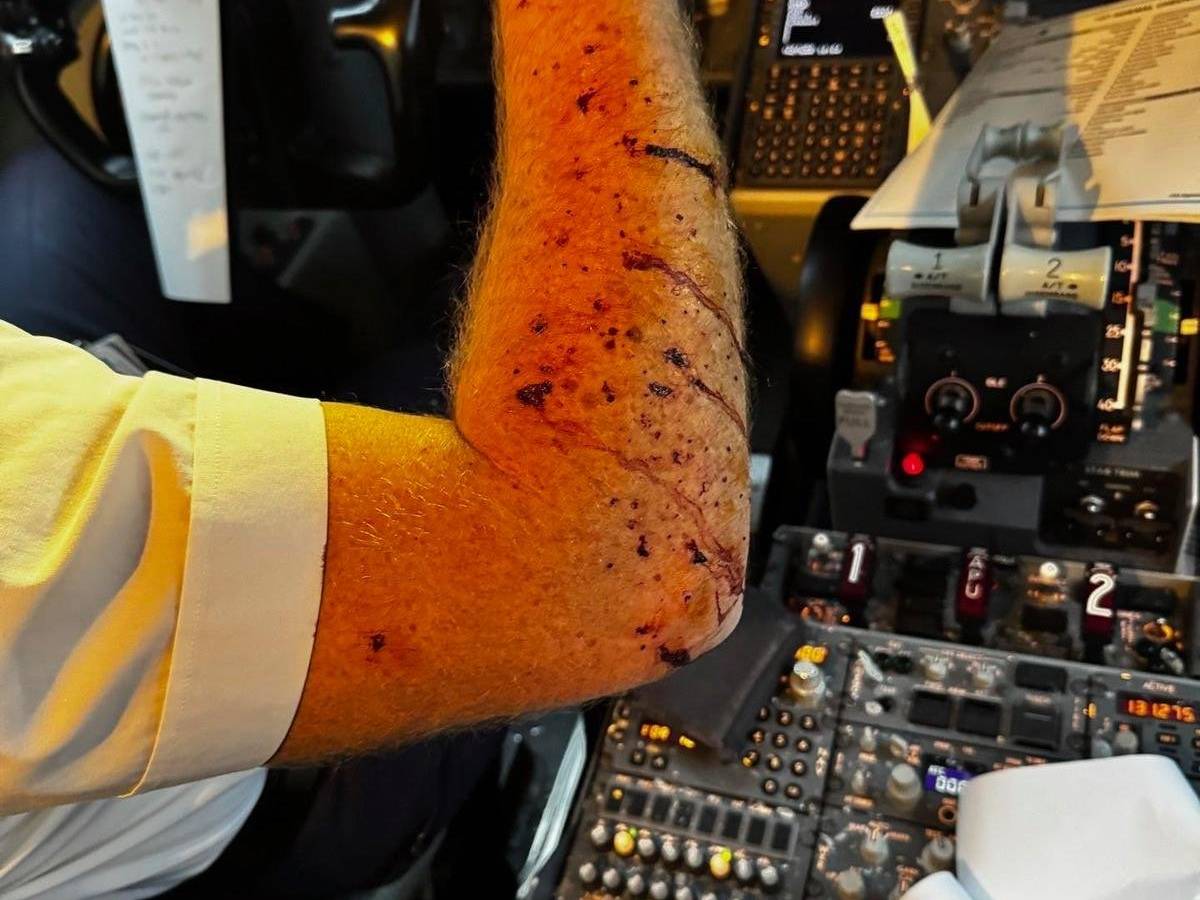 Paura a 11 mila metri di altezza, aereo colpito da un possibile "detrito spaziale": ferito il pilota Paura a 11 mila metri di altezza, aereo colpito da un possibile "detrito spaziale": ferito il pilota