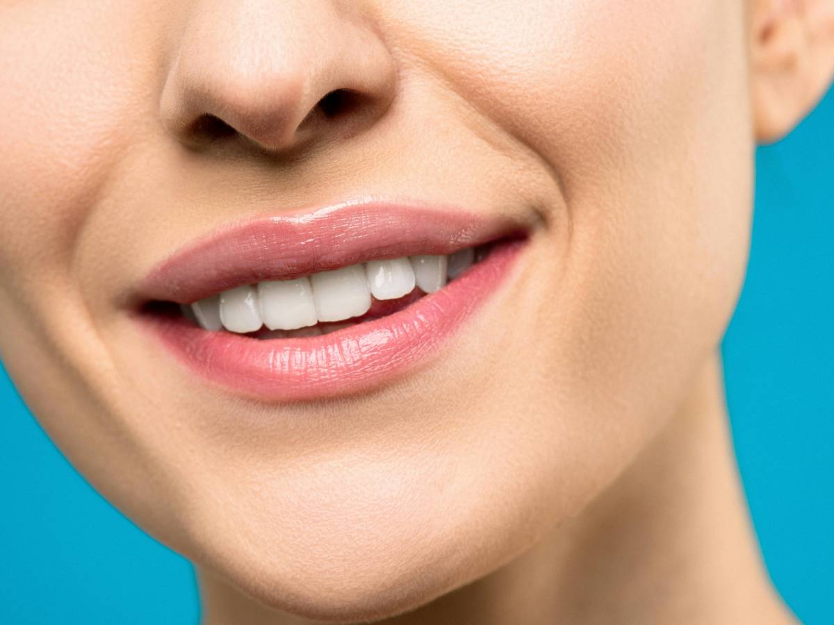 sei rimedi naturali per denti pi249 bianchi