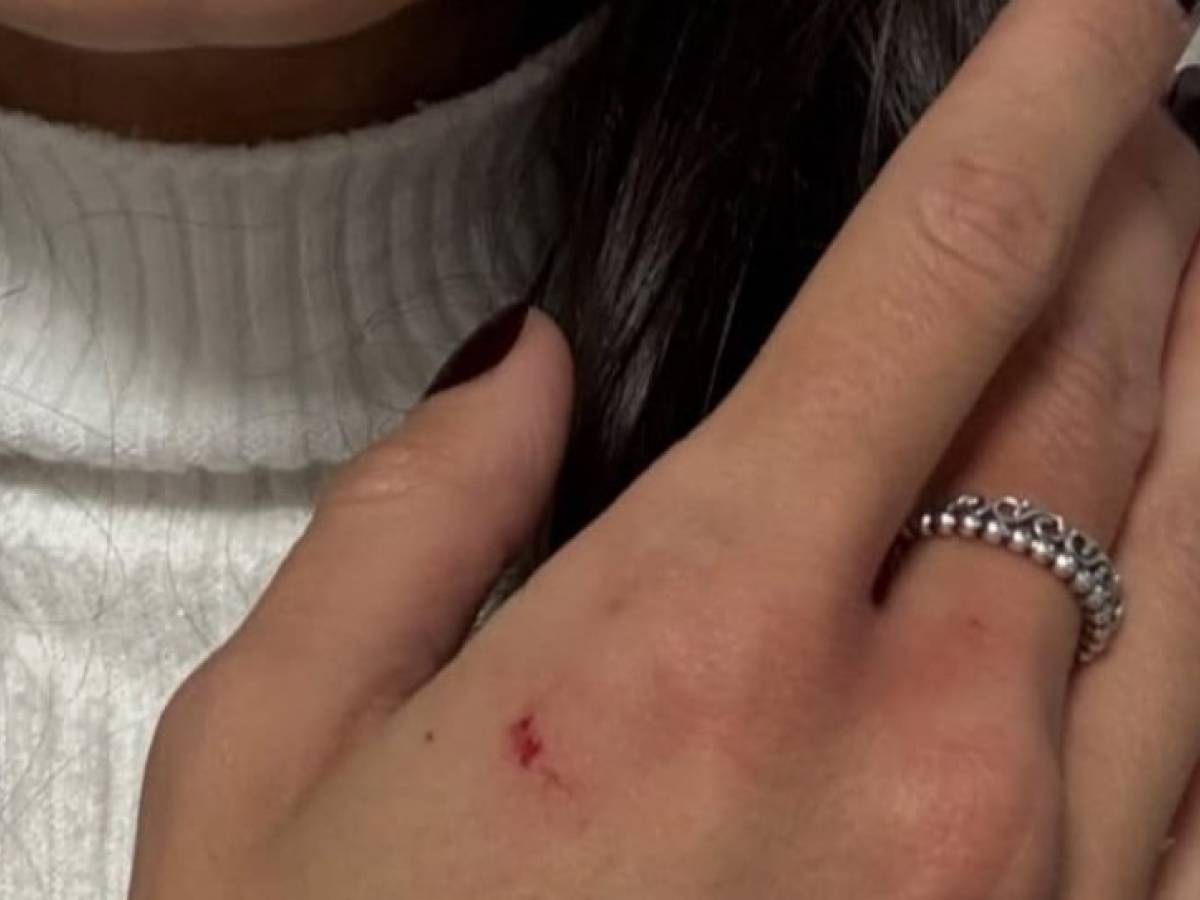 Aggredisce e picchia donne a caso senza motivo: immigrato trasferito al Cpr per il rimpatrio Aggredisce e picchia donne a caso senza motivo: immigrato trasferito al Cpr per il rimpatrio