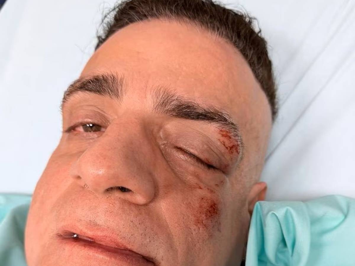 aggredito il cicalone lo youtuber vittima dei borseggiatori in metro a roma da Ilgiornale.it aggredito il cicalone lo youtuber vittima dei borseggiatori in metro a roma