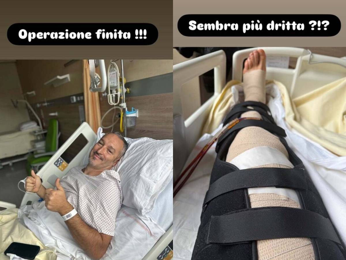"Sembra più dritta?": Zambrotta operato alle gambe, come sta l