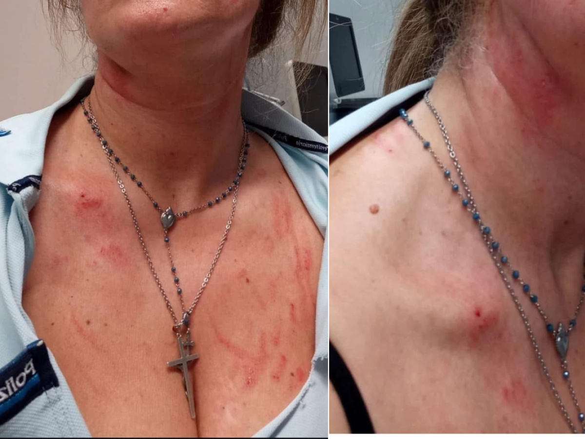 Calci, morsi, poi la violenza: la furia dello straniero contro un