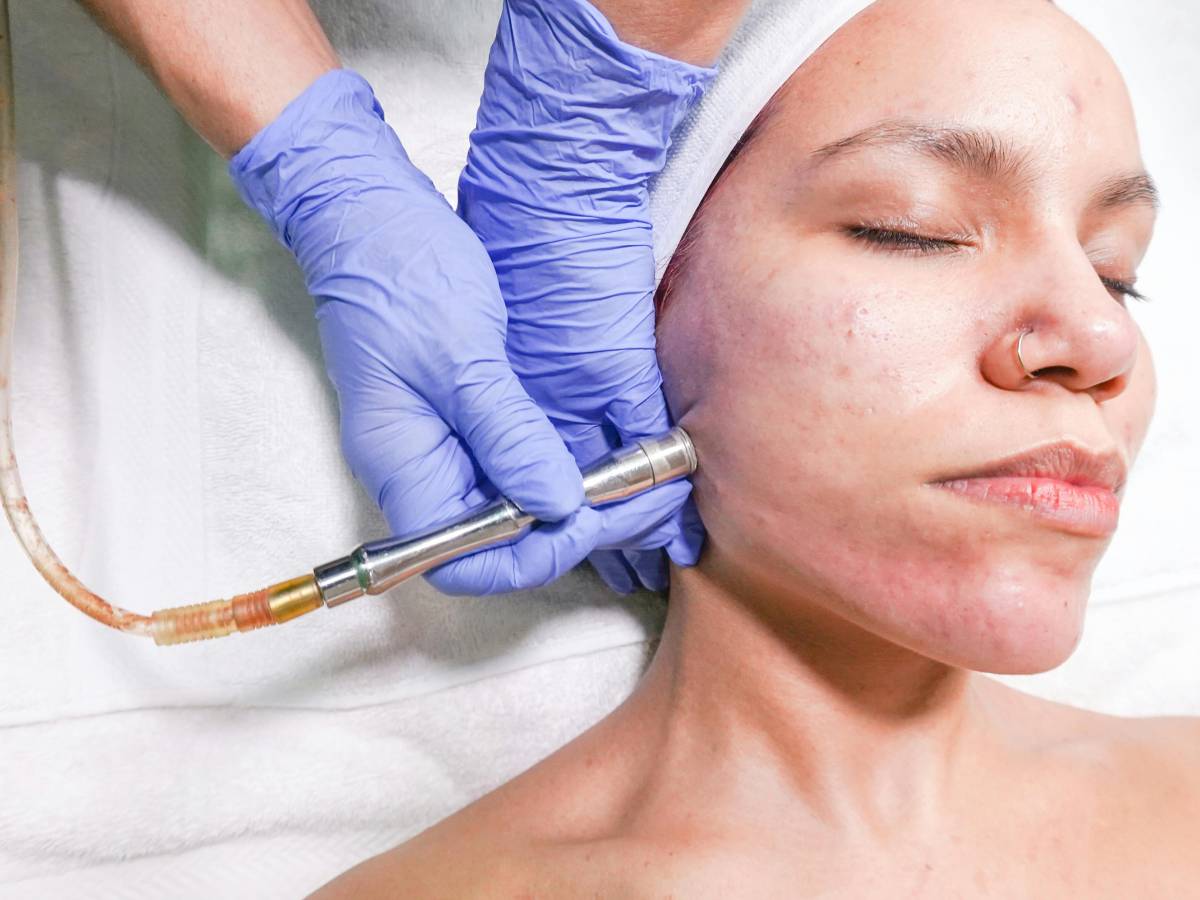 acne le diagnosi sono in aumento i 10 errori da evitare secondo la dermatologa da Ilgiornale.it acne le diagnosi sono in aumento i 10 errori da evitare secondo la dermatologa