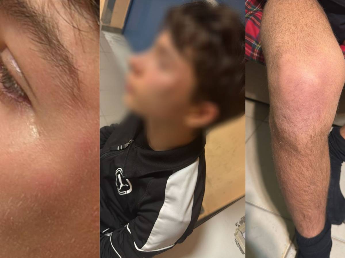 Calcio, la vergogna in campo: arbitro 15enne aggredito e ferito. La rabbia dell Calcio, la vergogna in campo: arbitro 15enne aggredito e ferito. La rabbia dell