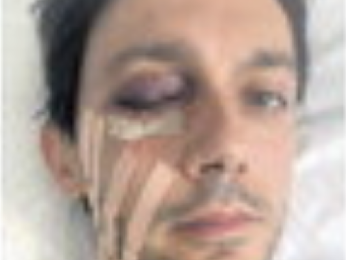 "Io sfigurato da un sasso. Neppure un messaggio dai responsabili del corteo" "Io sfigurato da un sasso. Neppure un messaggio dai responsabili del corteo"