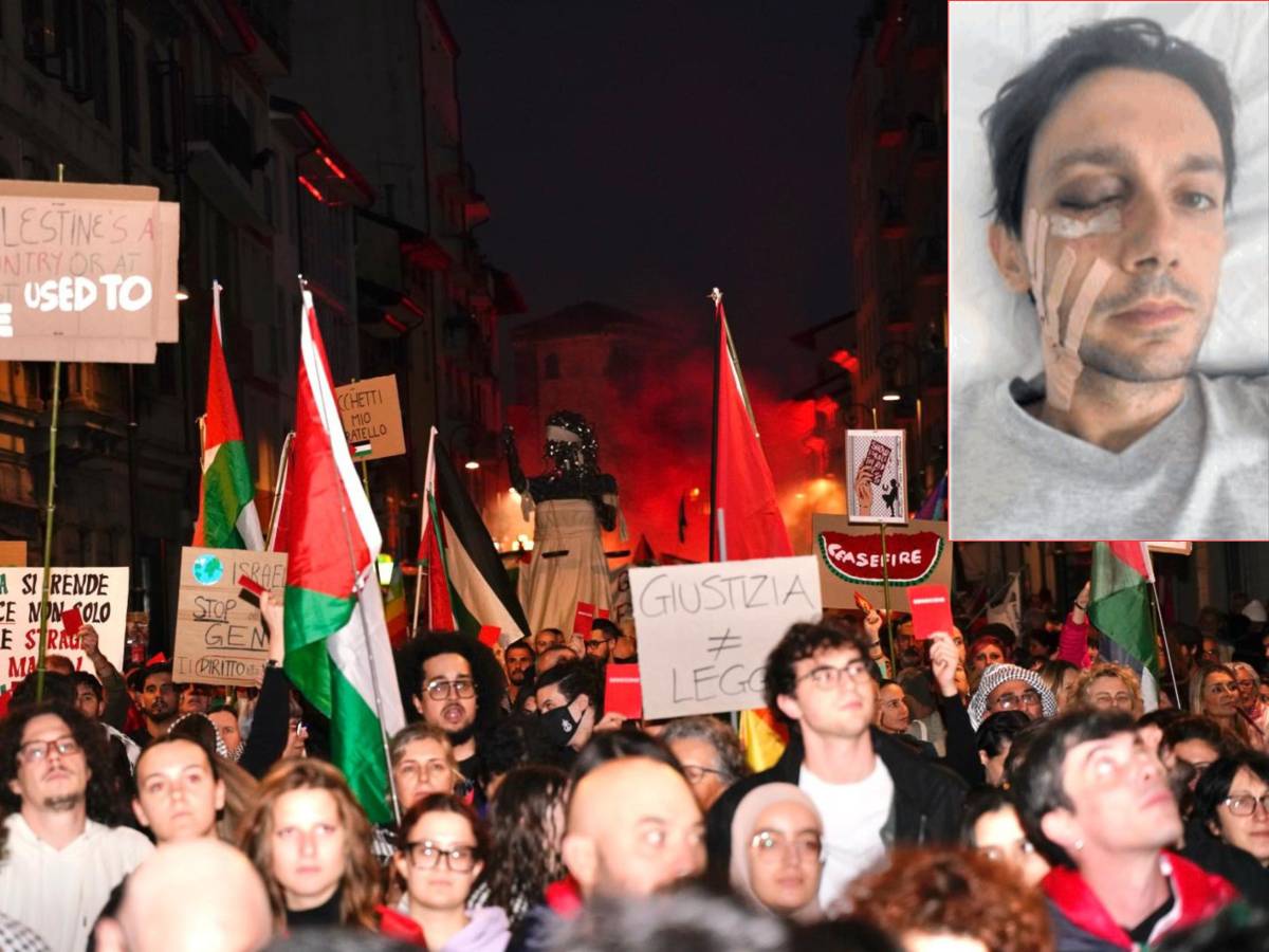 l8217abbraccio del governo al reporter sfigurato dall8217attacco antagonista da Ilgiornale.it l8217abbraccio del governo al reporter sfigurato dall8217attacco antagonista