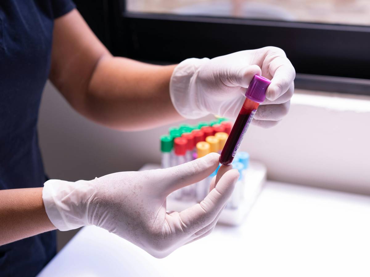 prevenire il rischio di ictus ecco i valori da tenere sotto controllo da Ilgiornale.it prevenire il rischio di ictus ecco i valori da tenere sotto controllo