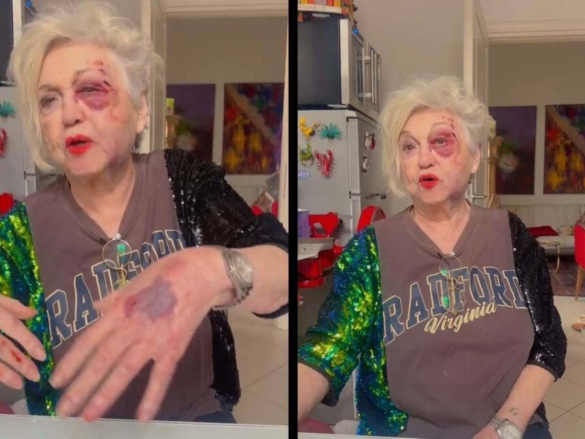 la macchina i sassi il dolore incredibile wanna marchi investita da un auto a milano da Ilgiornale.it la macchina i sassi il dolore incredibile wanna marchi investita da un auto a milano