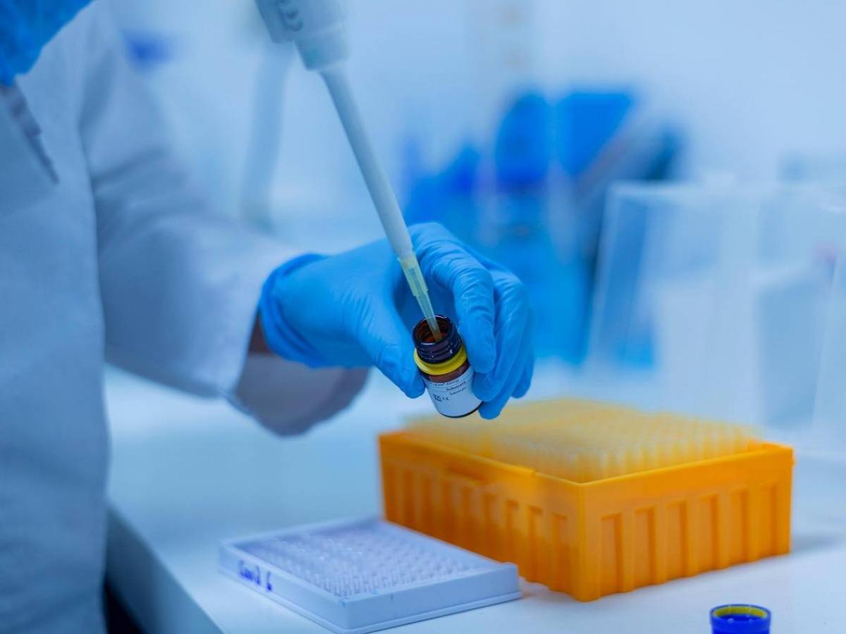 Alzheimer, aumentare i livelli di una molecola chiave protegge dalla malattia