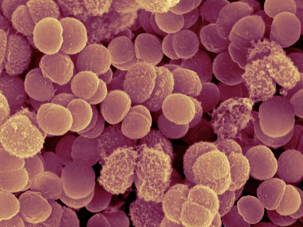 il batterio che sopravvive allo spazio e forse ci ha preceduti su marte come diceva nanni bignami i marziani siamo noi da Ilgiornale.it il batterio che sopravvive allo spazio e forse ci ha preceduti su marte come diceva nanni bignami i marziani siamo noi