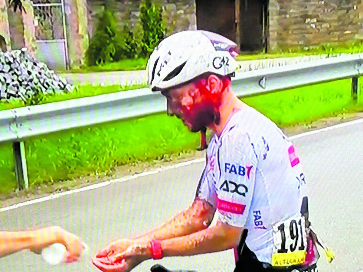 noia e paura maxi caduta niente ambulanze yates maschera di sangue da Ilgiornale.it noia e paura maxi caduta niente ambulanze yates maschera di sangue