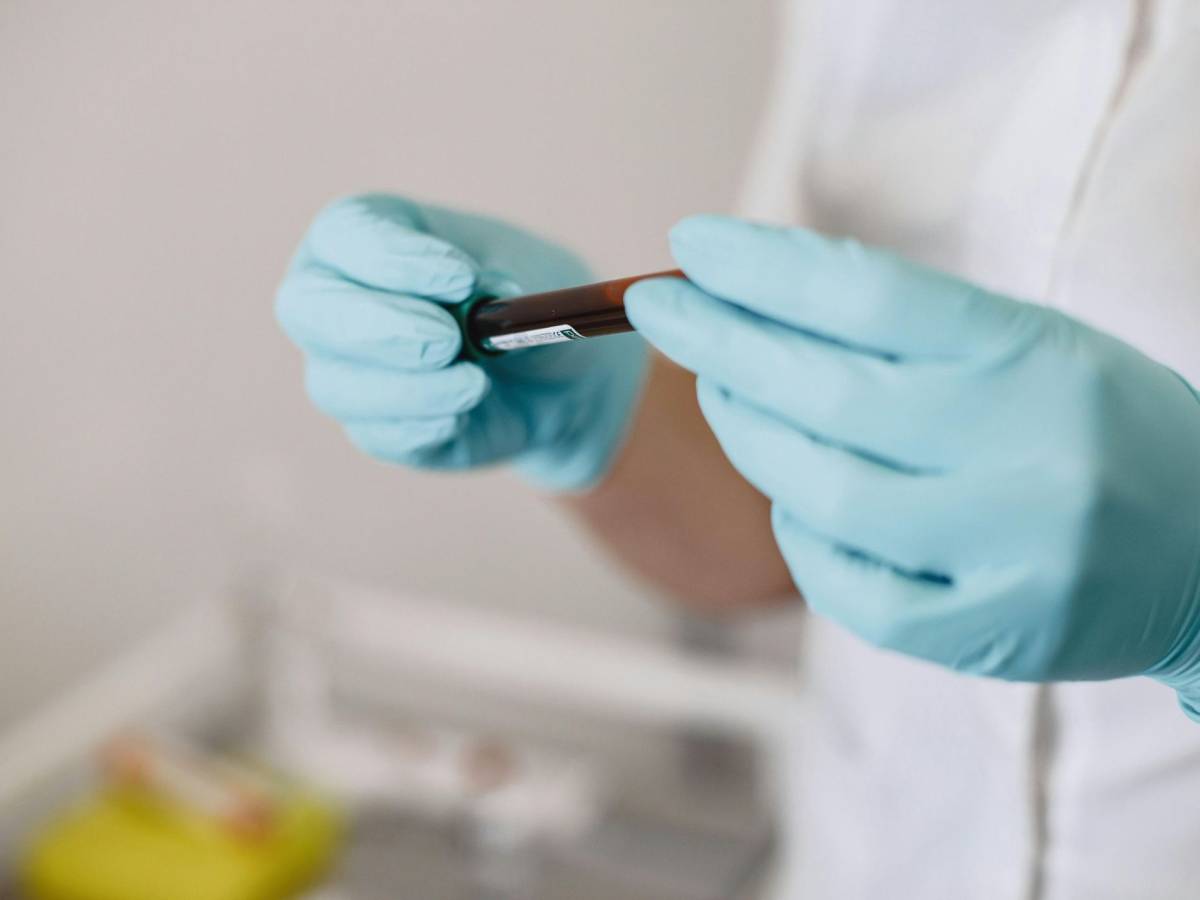 osteoporosi i primi sintomi in et224 adulta quali sono gli esami del sangue da fare da Ilgiornale.it osteoporosi i primi sintomi in et224 adulta quali sono gli esami del sangue da fare