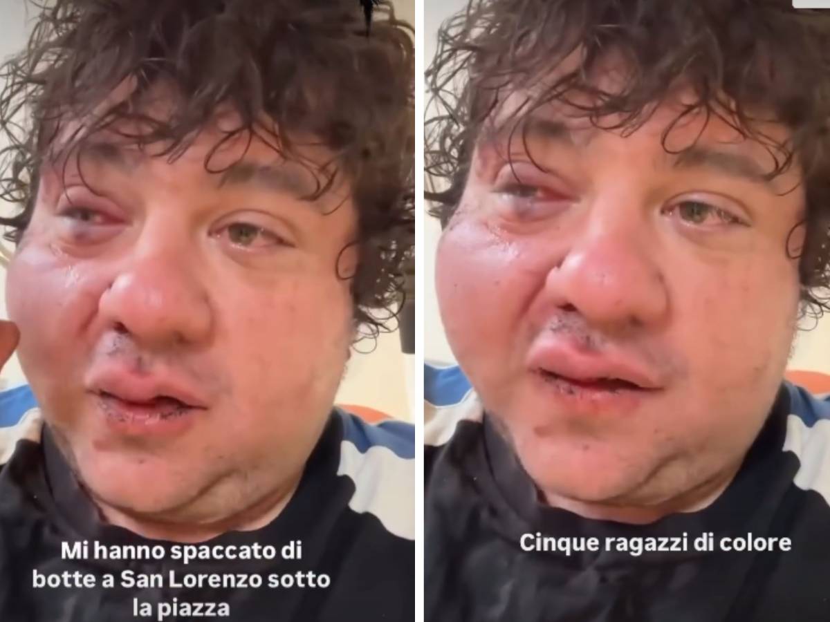 mi hanno spaccato di botte ex concorrente di x factor aggredito da cinque stranieri da Ilgiornale.it mi hanno spaccato di botte ex concorrente di x factor aggredito da cinque stranieri
