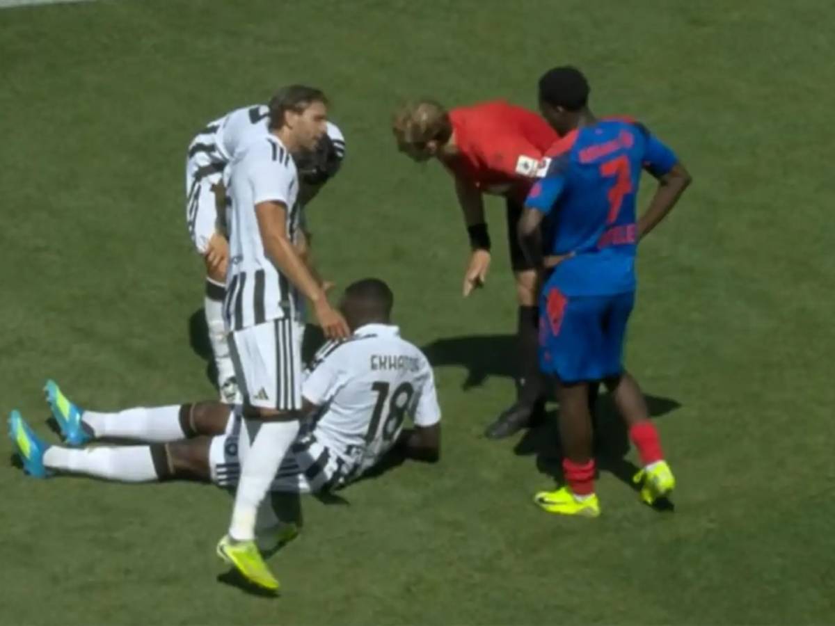 juve esordio senza squilli con l8217infortunio di ekhator spalletti gi224 senza punte da Ilgiornale.it juve esordio senza squilli con l8217infortunio di ekhator spalletti gi224 senza punte