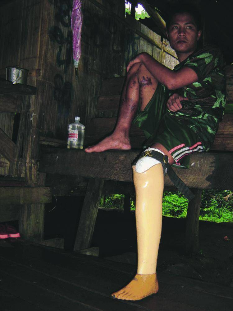 Nella giungla birmana in mezzo al popolo delle gambe perdute