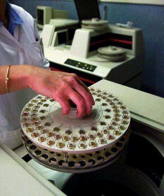 Fatta la coda, Burlando taglia le liste d’attesa