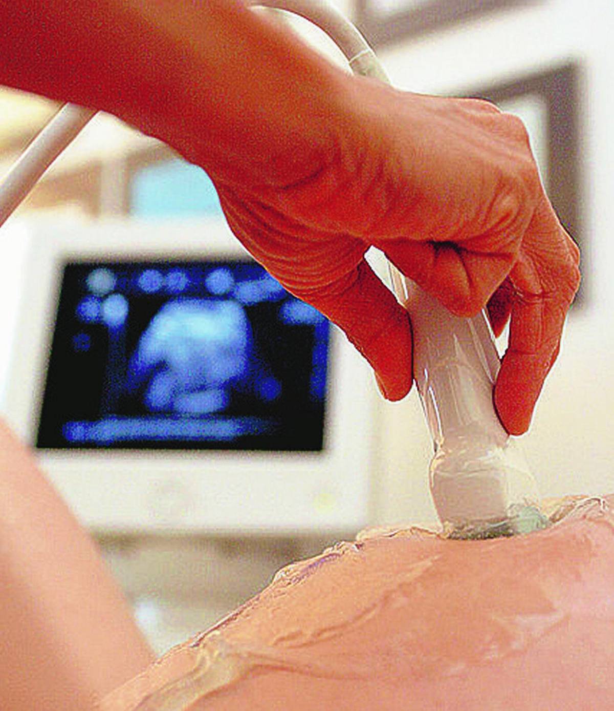 Ru486, la usano 26 ospedali Oltre mille aborti in un anno